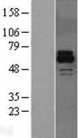 ACTRIIB / ACVR2B Protein - Western validation with an anti-DDK antibody * L: Control HEK293 lysate R: Over-expression lysate