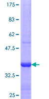 ACTRT1 Protein - 12.5% SDS-PAGE Stained with Coomassie Blue.