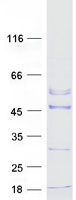 ACTRT2 Protein - Purified recombinant protein ACTRT2 was analyzed by SDS-PAGE gel and Coomassie Blue Staining