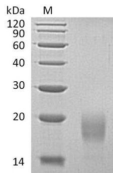 ACVR1B / ALK4 Protein - (Tris-Glycine gel) Discontinuous SDS-PAGE (reduced) with 5% enrichment gel and 15% separation gel.