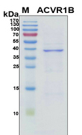 ACVR1B / ALK4 Protein - SDS-PAGE under reducing conditions and visualized by Coomassie blue staining