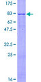 ACVR1B / ALK4 Protein - 12.5% SDS-PAGE of human ACVR1B stained with Coomassie Blue
