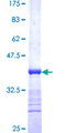 ACVR1B / ALK4 Protein - 12.5% SDS-PAGE Stained with Coomassie Blue.
