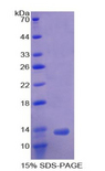 ACVR1B / ALK4 Protein - Recombinant Activin A Receptor Type I B By SDS-PAGE