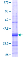 ACVR1C / ALK7 Protein - 12.5% SDS-PAGE Stained with Coomassie Blue.
