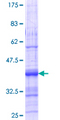 ACVR1C / ALK7 Protein - 12.5% SDS-PAGE Stained with Coomassie Blue.