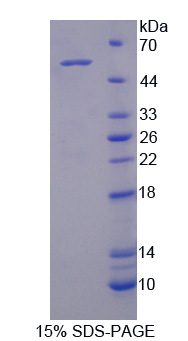 ACVR1C / ALK7 Protein - Recombinant Activin A Receptor Type I C By SDS-PAGE