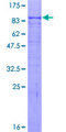 ACVR2 / ACVR2A Protein - 12.5% SDS-PAGE of human ACVR2A stained with Coomassie Blue