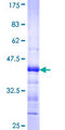 ACVR2 / ACVR2A Protein - 12.5% SDS-PAGE Stained with Coomassie Blue.