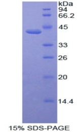 ACVR2 / ACVR2A Protein - Recombinant Activin A Receptor Type II A By SDS-PAGE