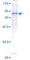 ACVRL1 Protein - 12.5% SDS-PAGE of human ACVRL1 stained with Coomassie Blue