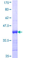 ACVRL1 Protein - 12.5% SDS-PAGE Stained with Coomassie Blue.