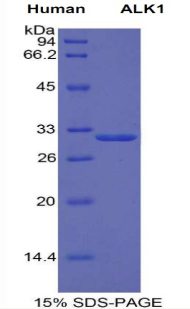 ACVRL1 Protein - Recombinant Activin Receptor Like Kinase 1 (ALK1) by SDS-PAGE