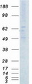 ACVRL1 Protein - Purified recombinant protein ACVRL1 was analyzed by SDS-PAGE gel and Coomassie Blue Staining