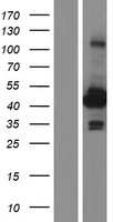 ACY1 / Aminoacylase 1 Protein - Western validation with an anti-DDK antibody * L: Control HEK293 lysate R: Over-expression lysate