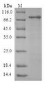 ACY1 / Aminoacylase 1 Protein - (Tris-Glycine gel) Discontinuous SDS-PAGE (reduced) with 5% enrichment gel and 15% separation gel.