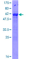 ACY3 Protein - 12.5% SDS-PAGE of human ACY3 stained with Coomassie Blue