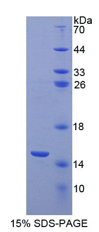 ACYP1 Protein - Recombinant Acylphosphatase 1, Erythrocyte By SDS-PAGE