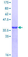 ACYP2 Protein - 12.5% SDS-PAGE of human ACYP2 stained with Coomassie Blue