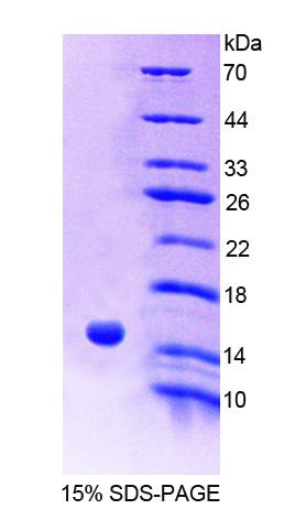 ACYP2 Protein - Recombinant Acylphosphatase 2, Muscle By SDS-PAGE