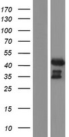 ADA / Adenosine Deaminase Protein - Western validation with an anti-DDK antibody * L: Control HEK293 lysate R: Over-expression lysate
