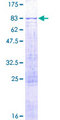 ADAD1 Protein - 12.5% SDS-PAGE of human ADAD1 stained with Coomassie Blue