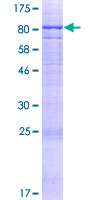 ADAD2 Protein - 12.5% SDS-PAGE of human ADAD2 stained with Coomassie Blue