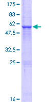 ADAL Protein - 12.5% SDS-PAGE of human ADAL stained with Coomassie Blue