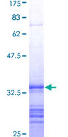 ADAM10 Protein - 12.5% SDS-PAGE Stained with Coomassie Blue.