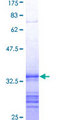 ADAM10 Protein - 12.5% SDS-PAGE Stained with Coomassie Blue.