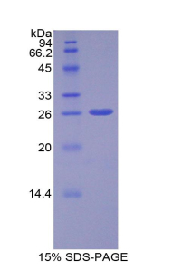 ADAM10 Protein - Recombinant A Disintegrin And Metalloprotease 10 By SDS-PAGE