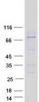 ADAM11 Protein - Purified recombinant protein ADAM11 was analyzed by SDS-PAGE gel and Coomassie Blue Staining