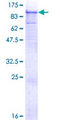 ADAM12 Protein - 12.5% SDS-PAGE of human ADAM12 stained with Coomassie Blue