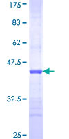 ADAM12 Protein - 12.5% SDS-PAGE Stained with Coomassie Blue.