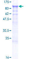 ADAM15 Protein - 12.5% SDS-PAGE of human ADAM15 stained with Coomassie Blue