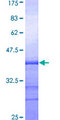 ADAM15 Protein - 12.5% SDS-PAGE Stained with Coomassie Blue.