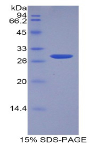 ADAM15 Protein