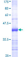 ADAM17 / TACE Protein - 12.5% SDS-PAGE Stained with Coomassie Blue.