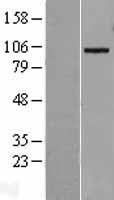 ADAM19 Protein - Western validation with an anti-DDK antibody * L: Control HEK293 lysate R: Over-expression lysate