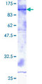 ADAM2 / Fertilin Beta Protein - 12.5% SDS-PAGE of human ADAM2 stained with Coomassie Blue