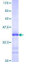 ADAM2 / Fertilin Beta Protein - 12.5% SDS-PAGE Stained with Coomassie Blue.