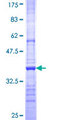 ADAM20 Protein - 12.5% SDS-PAGE Stained with Coomassie Blue.