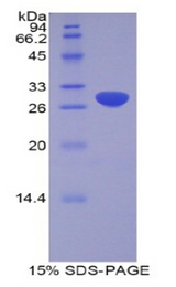 ADAM20 Protein - Recombinant A Disintegrin And Metalloprotease 20 By SDS-PAGE