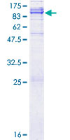 ADAM21 Protein - 12.5% SDS-PAGE of human ADAM21 stained with Coomassie Blue