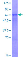 ADAM22 Protein - 12.5% SDS-PAGE of human ADAM22 stained with Coomassie Blue