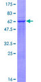 ADAM22 Protein - 12.5% SDS-PAGE of human ADAM22 stained with Coomassie Blue