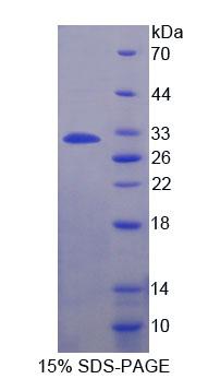 ADAM22 Protein - Recombinant A Disintegrin And Metalloprotease 22 By SDS-PAGE