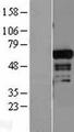 ADAM28 Protein - Western validation with an anti-DDK antibody * L: Control HEK293 lysate R: Over-expression lysate