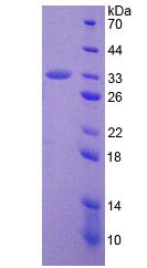 ADAM28 Protein - Recombinant A Disintegrin And Metalloprotease 28 By SDS-PAGE
