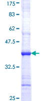 ADAM30 Protein - 12.5% SDS-PAGE Stained with Coomassie Blue.